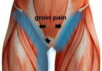 groin pain