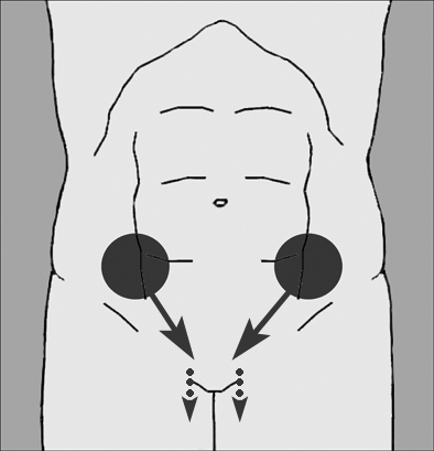 groin pain