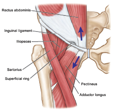 groin pain